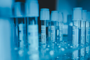 There is a lot of equipment in the lab, the atmosphere inside the laboratory is filled with experimental glassware, items that scientists use to do their work efficiently