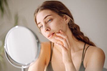 Young woman with problem skin looking into mirror. Concept of acne therapy, scars, inflammation on...