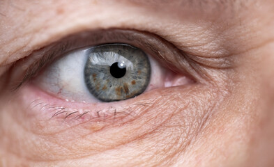 close-up mature female eye looking to side, concept of patient care, wrinkles around eyes, upper...