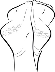 Cracked dry skin on woman's heels, Line drawing of the left and right foot soles