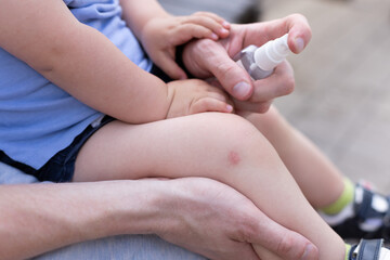 Father spraying antiseptic to the knee of the child sitting on the bench in the park.