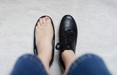 Foot deforming shoes. Incorrect anatomical shoes with flat soles. Small insole size, which causes foot pain. Cause of valgus, calluses, ingrown toenails