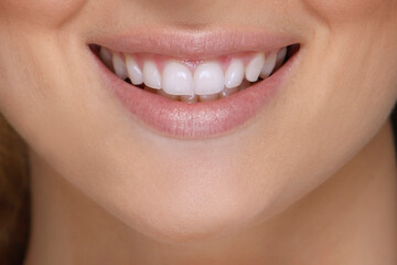 Obraz premium beautiful smile of a woman with teeth