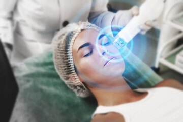 Radio frequency (RF) skin tightening on a female patient in a medical aesthetic clinic