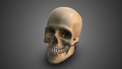 A skull with Broken Jaw