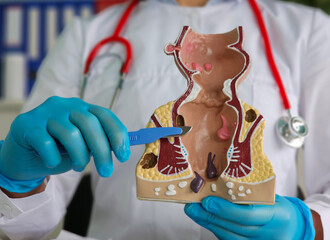 doctor explaining the anatomy of the rectum and anus using a detailed model concept