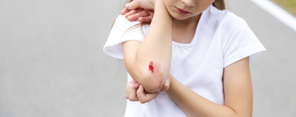 The girl cut her elbow after falling from a scooter