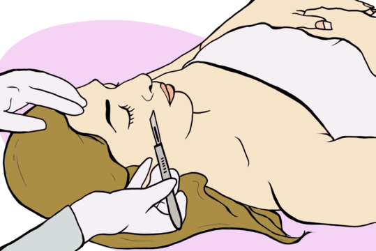 young woman receiving a demaplanign treatment with a scalpel in the hands of her professional beautician
- Powered by Adobe