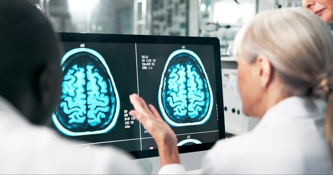 Team, doctors and monitor for brain scan in hospital, neurology and planning for surgery in meeting. Employees, healthcare and radiology results of tumor assessment, xray and speaking on strategy