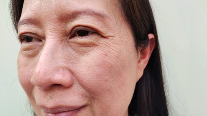 portrait the wrinkle and Flabby skin, Flabbiness and loose, swelling and ptosis, dark spots and...