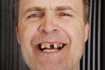 Obraz premium Photo of a man's head with his mouth open.