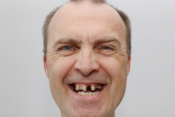 Close-up portrait of a psycho with missing teeth.