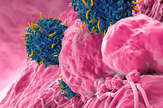 CAR T cell therapy in Thyroid cancer - closeup view 3d illustration