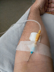 Close-up of a patient's arm with an IV on a hospital bed. The patient's hand, a needle with saline solution in the patient's hand during treatment in the hospital. Soft focus.