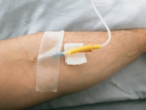 The patient's arm with an IV. The patient's hand, a needle with saline solution in the patient's hand during treatment in the hospital. Soft focus. The patient's arm with an intravenous drip.