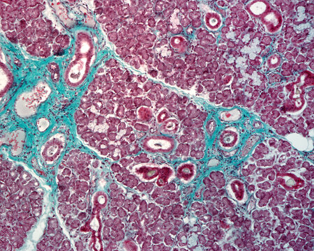 Submandibular gland. Trichrome stain