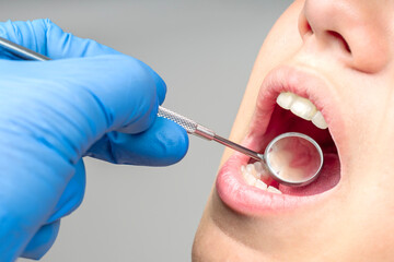 Close up of dentist hand examining patient teeth with dental mirror in a checkup.