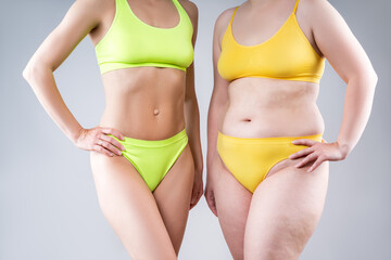 Before after weight loss, tummy tuck, fat and thin women with flabby and muscular bellies on gray...