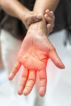Peripheral Neuropathy pain, Peripheral Nervous System, Guillain-Barre Syndrome GBS in elderly aged old patient on hand, sensory nerves with numb, muscle weakness