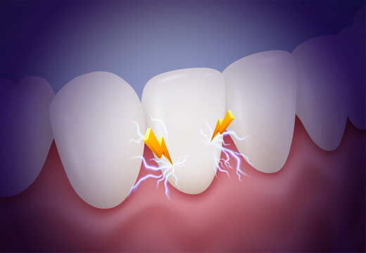 Sensitive teeth sharp pain like an electric shock or lightning strike. Tooth sensitivity treatment symptom concept. Realistic vector illustration.