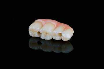 Dental bridge four teeth and artificial gum made of monolithic zirconium for fixation on implants
