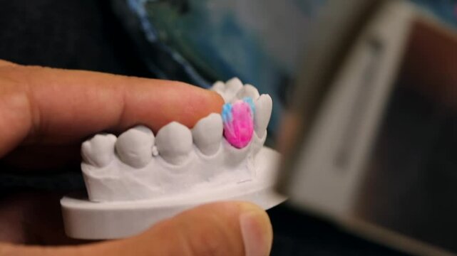great moment as a dental technician applies different colors of ceramics to the crown of a central tooth