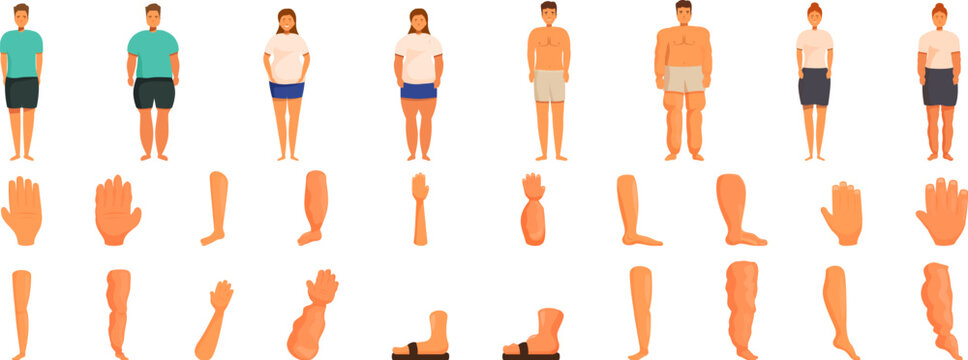 Edema icons set. People standing showing different body parts posing for a medical exam
