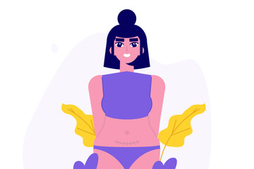 Women with cesarean scar. Stitches after caesarean section, C-section concept. Vector flat illustration isolated white background.