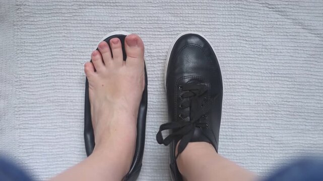 Foot deforming shoes. Incorrect anatomical shoes with flat soles. Small insole size, which causes foot pain. Cause of valgus, calluses, ingrown toenails
