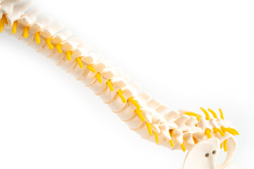 Lumbar spine displaced herniated disc fragment, spinal nerve and bone. Model for treatment medical...