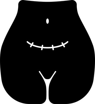 Cesarean Icon Illustration