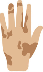 Flat Leprosy Hands Illustration Design