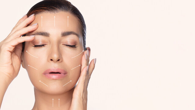 Surgery and Anti Aging Concept. Beauty Face Spa Woman with Closed Eyes Showing facial lifting lines.