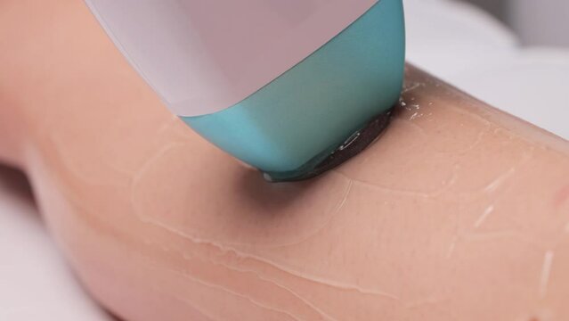 Elos epilation hair removal procedure on a woman&rsquo;s body. Beautician doing laser rejuvenation on the lower leg in a beauty salon. Removing unwanted body hair. Hardware ipl cosmetology