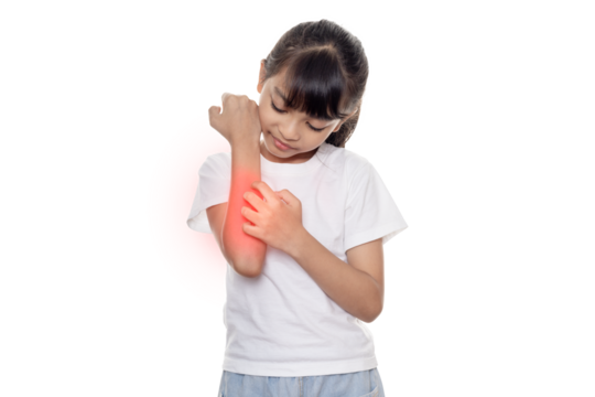 Asian little girl has skin rash allergy and itchy on her arm isolated on white background with clipping path.