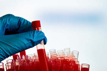 Lab technician in glove holds test tube with blood. Laboratory test tubes with blood tests on blue...