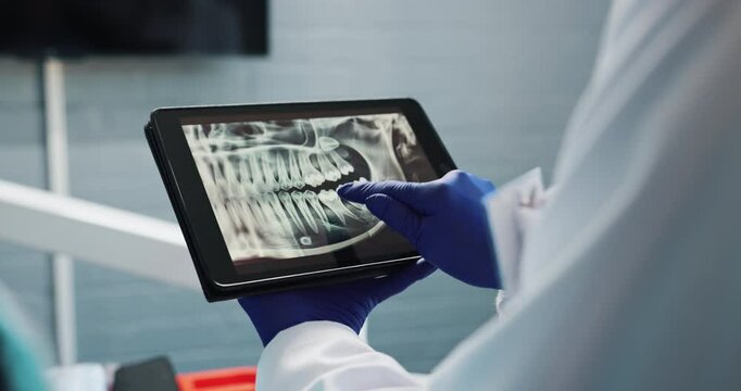 Dentist, consulting and xray of teeth on tablet for patient education, dental diagnosis and treatment planning. Oral assessment, online and explain with image for hygiene instruction and discussion.