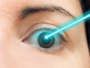 Close-up of brown eye treated with LASIK or LASEK blue laser beam surgery process for vision...