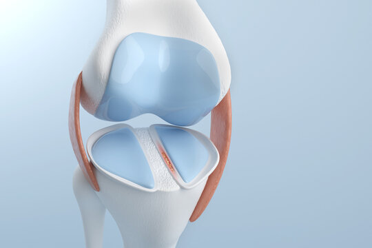 Knee pain from Meniscus Tear for medical and treatment. 3D illustration.