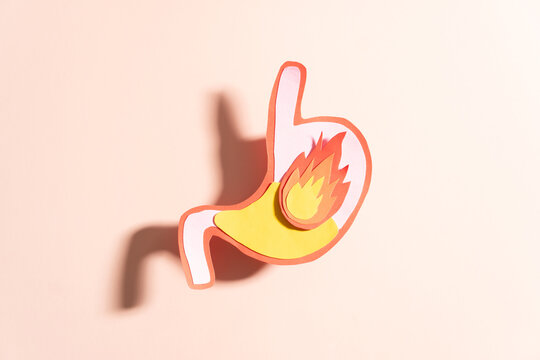 Human stomach burn with acid reflux and fire made from paper. Gastroesophageal reflux disease (GERD) or heartburn symptoms. Gastrointestinal system disease and digestive problems.