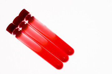 Laboratory test tubes with lids and blood samples on a light background