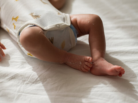 Closeup of newborn's peeling skin