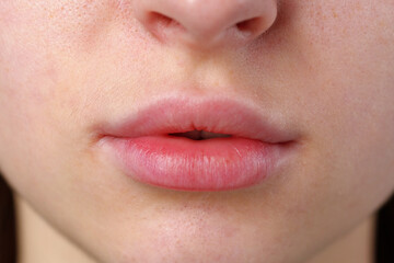 Close Up of Womans Lips and Nose