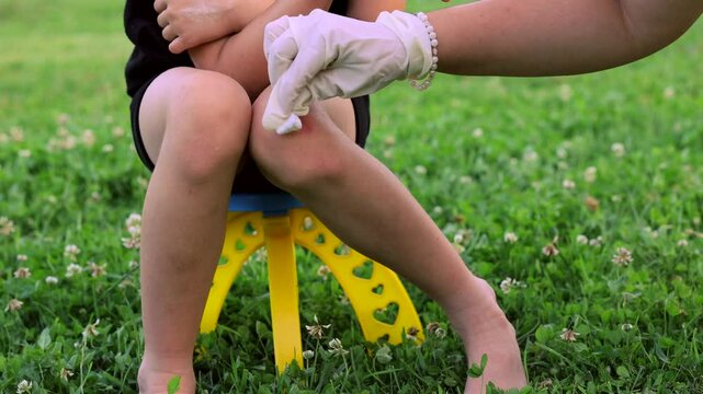During the game, the child injured his knee on a summer day. The mother examines the child's knee and washes the wound