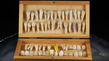 collection of ceramic and real teeth for demonstration and training of dental technicians, shot on black background