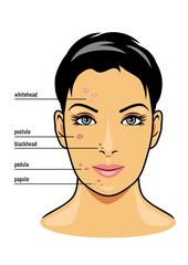 Different types of facial skin acne