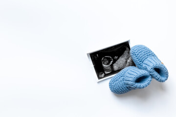 Ultrasound image of a fertilized egg. Planning a baby. Pregnancy and conceiving a child concept