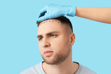 Doctor and marked man's forehead with hair loss problem on blue background, closeup