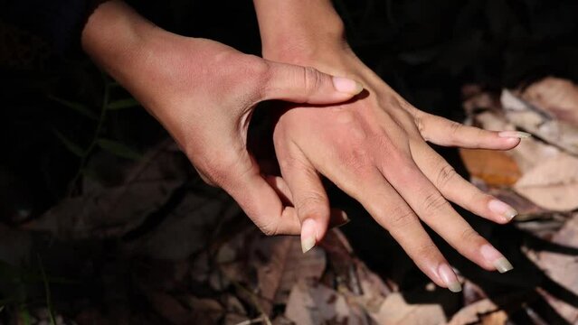 A woman's hand bitten by a mosquito has skin rash allergy, Itching, and scratching on the of her hand.