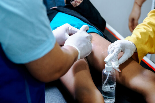 Circumcision in children, step by step procedure. Content is for educational purposes only.